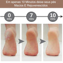 Esfoliador Elétrico para Pés – Lixa Removedora de Calos Portátil USB ou Pilha